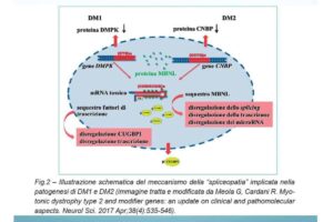 Distrofia miotonica-comportamento-del-gene-FMM